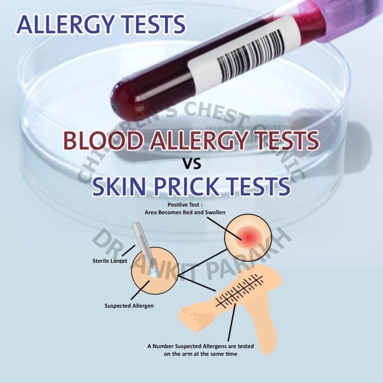 Skin Prick Test (SPT) vs Blood Allergy Tests: Which is better for ...