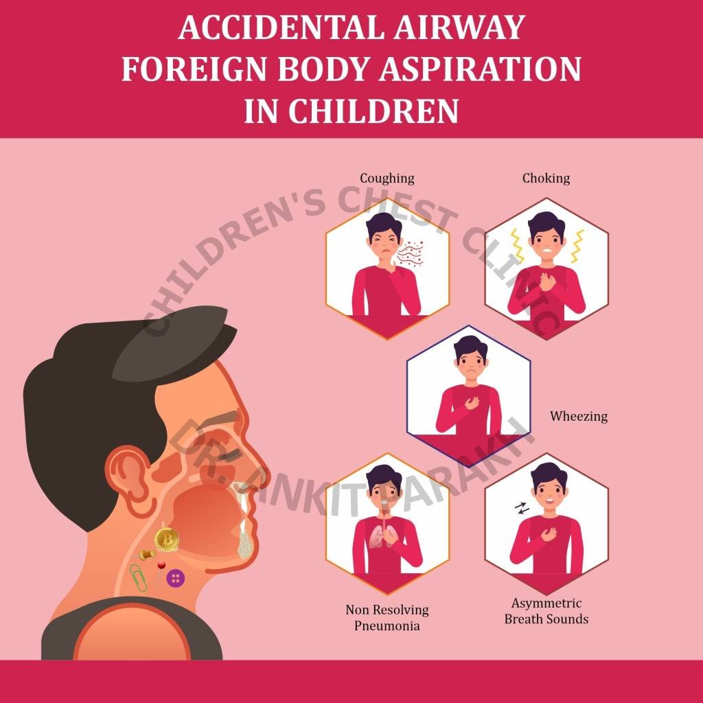 Foreign Body Aspiration in Children Symptoms, investigations and