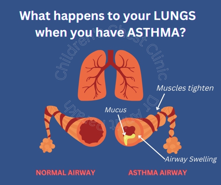 What happens to your lungs when you have Asthma? Dr. Ankit Parakh